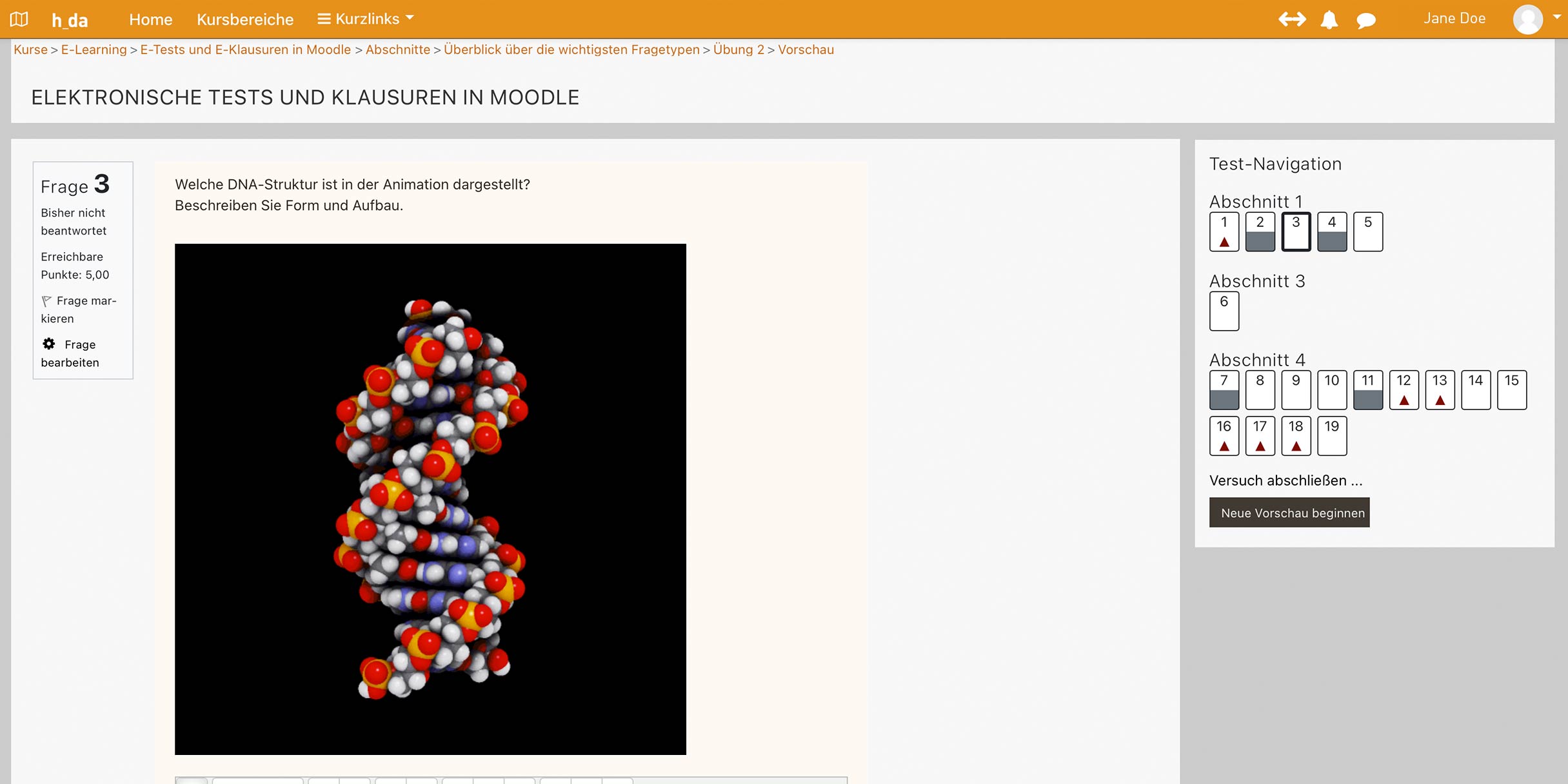 Screenshot aus einem elektronischem Test mit einer sich drehenden DNA Spirale mit der Frage, um welche DNA-Struktur es sich handelt. 